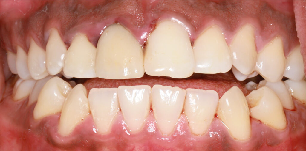 BEFORE-FRONT12-1(#8,#9)-resize