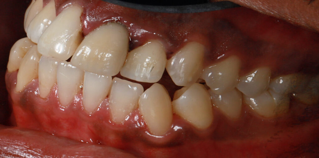 BEFORE-RIGHT SIDE12-2(#8,#9)-resize